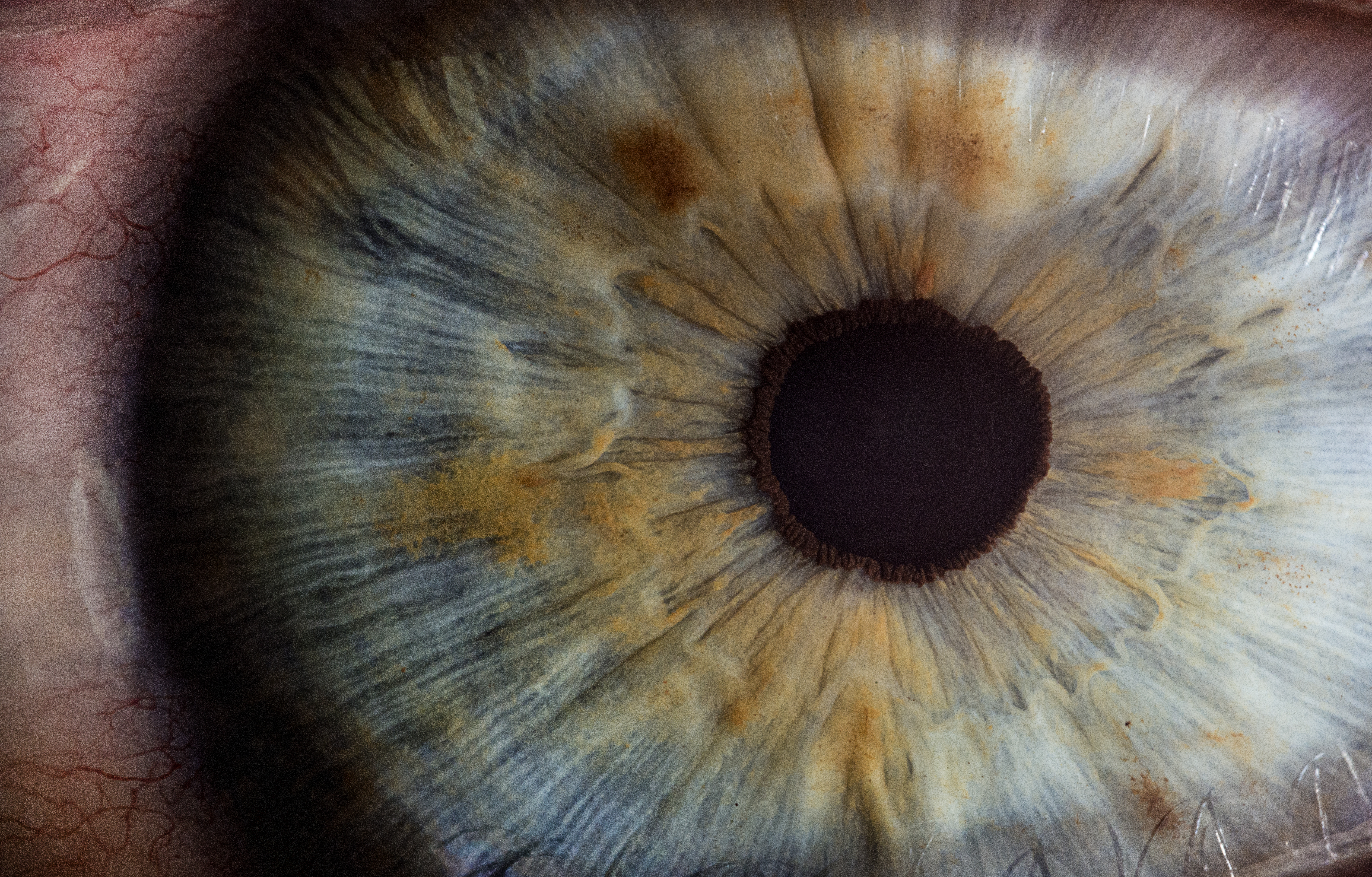 Human eye.