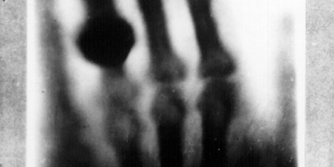 X-ray image of hand.